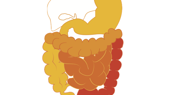 Crohn síntomas y dieta